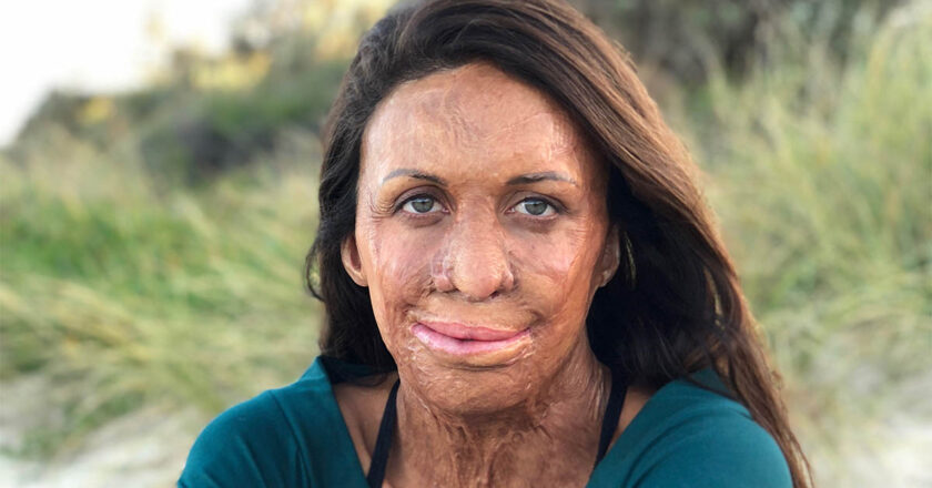 Turia Pritt’s Story of Hope